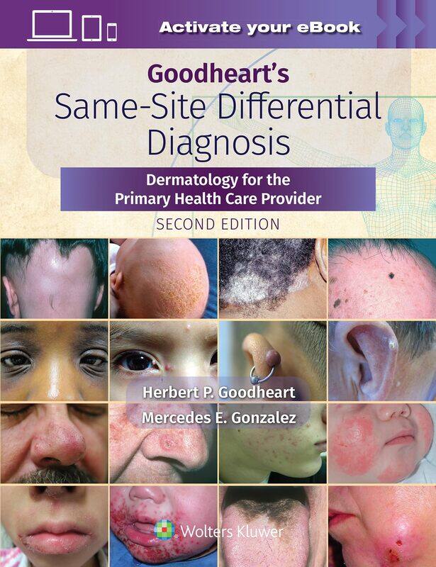 Goodheart's Same-Site Differential Diagnosis: Dermatology for the Primary Health Care Provider
Goodheart's Same-Site Differential Diagnosis: Dermatology for the Primary Health Care Provider