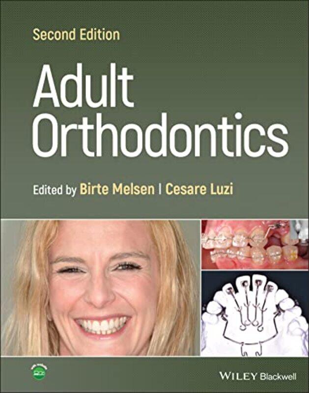 Adult Orthodontics by Wilbur J University of Oklahoma ScottKarin Modesto US Air Force Academy De AngelisDavid R University of Maryland USA Segal-Hardc
Adult Orthodontics by Wilbur J University of Oklahoma ScottKarin Modesto US Air Force Academy De AngelisDavid R University of Maryland USA Segal-Hardc