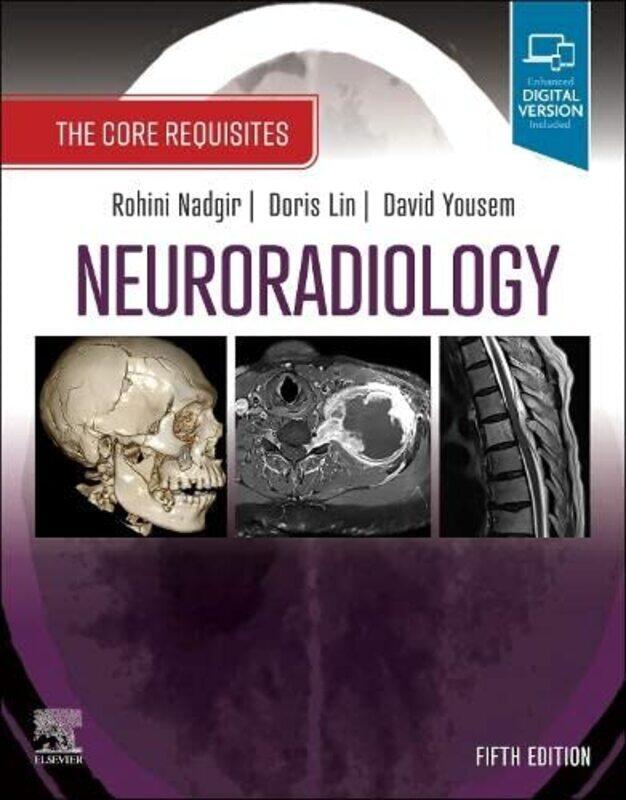 Neuroradiology The Core Requisites By Nadgir, Rohini (Assistant Professor, Radiology And Radiological Science, Johns Hopkins School Of Med - Paperback
Neuroradiology The Core Requisites By Nadgir, Rohini (Assistant Professor, Radiology And Radiological Science, Johns Hopkins School Of Med - Paperback