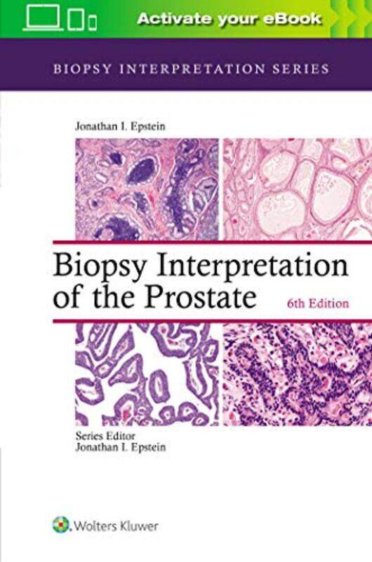 Biopsy Interpretation of the Prostate by Shelly NewsteadEmma Association of Playworkers UK Isles-Buck-Hardcover
Biopsy Interpretation of the Prostate by Shelly NewsteadEmma Association of Playworkers UK Isles-Buck-Hardcover