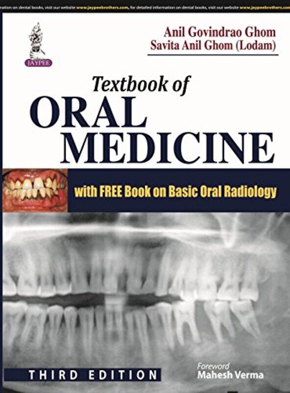 Textbook Of Oral Medicine by Ghom, Anil Govindrao - Ghom, Savita Anil (Lodam) - Paperback
Textbook Of Oral Medicine by Ghom, Anil Govindrao - Ghom, Savita Anil (Lodam) - Paperback