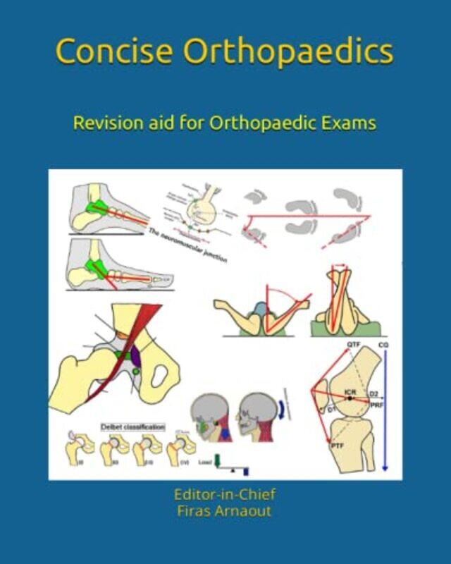 Concise Orthopaedic Notes: Revision aid for FRCS, EBOT , SICOT and Board Examinations,Paperback by Arnaout Frcs, Firas
Concise Orthopaedic Notes: Revision aid for FRCS, EBOT , SICOT and Board Examinations,Paperback by Arnaout Frcs, Firas