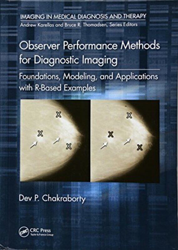 Observer Performance Methods for Diagnostic Imaging by Dev P Chakraborty-Hardcover
Observer Performance Methods for Diagnostic Imaging by Dev P Chakraborty-Hardcover