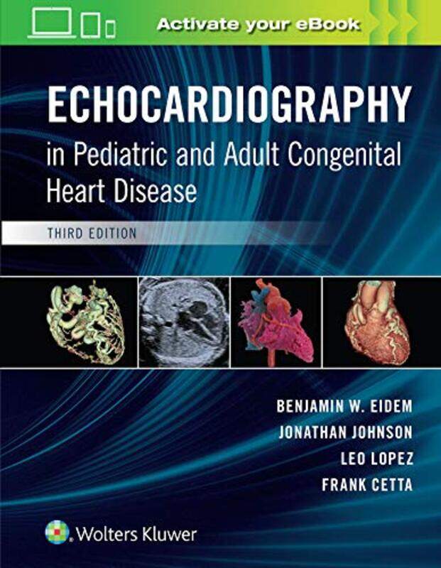 Echocardiography in Pediatric and Adult Congenital Heart Disease by American Library Assocation ALA-Hardcover
Echocardiography in Pediatric and Adult Congenital Heart Disease by American Library Assocation ALA-Hardcover