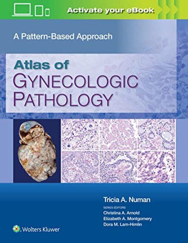 Atlas of Gynecologic Pathology: A Pattern Based Approach,Hardcover by Murdock, Tricia, MD
Atlas of Gynecologic Pathology: A Pattern Based Approach,Hardcover by Murdock, Tricia, MD