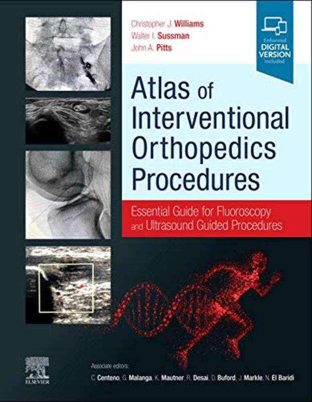 Atlas of Interventional Orthopedics Procedures by Michael Director Sussex Centre for euroscience University of Sussex O'Shea-Hardcover
Atlas of Interventional Orthopedics Procedures by Michael Director Sussex Centre for euroscience University of Sussex O'Shea-Hardcover