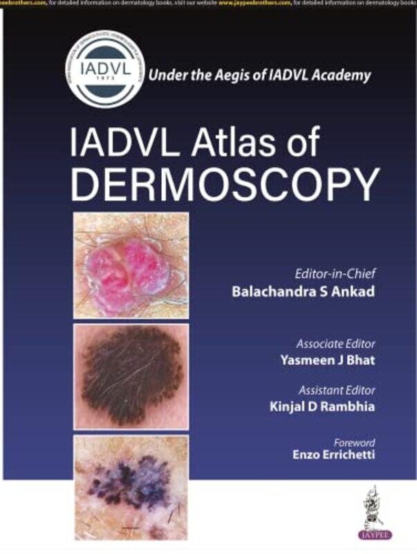 Atlas of Dermoscopy by David L Cornell University BrownKai A Pennsylvania State University Schafft-Paperback
Atlas of Dermoscopy by David L Cornell University BrownKai A Pennsylvania State University Schafft-Paperback