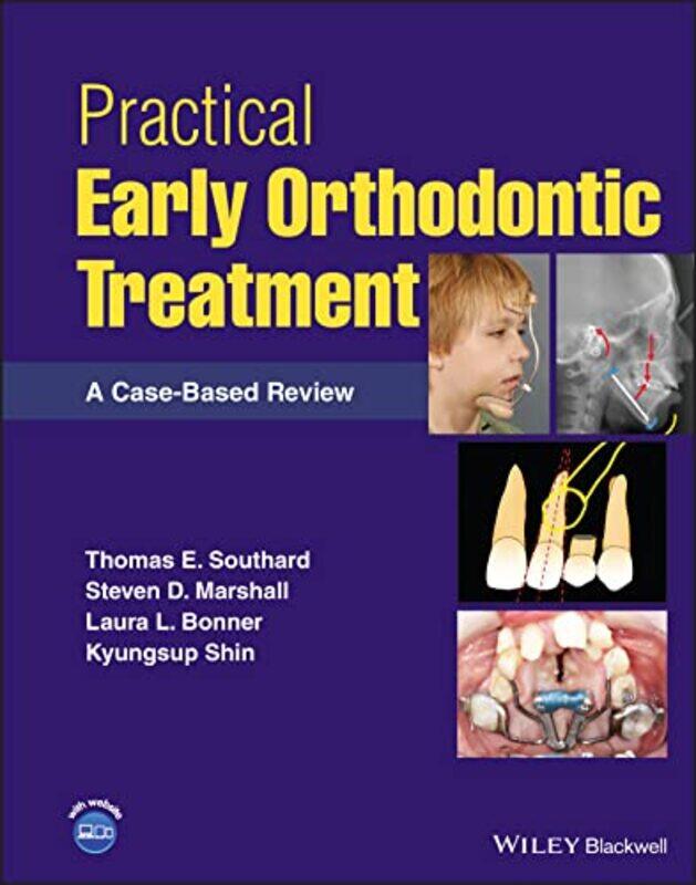 Practical Early Orthodontic Treatment: A Case-Base d Review,Hardcover,by:Southard
Practical Early Orthodontic Treatment: A Case-Base d Review,Hardcover,by:Southard