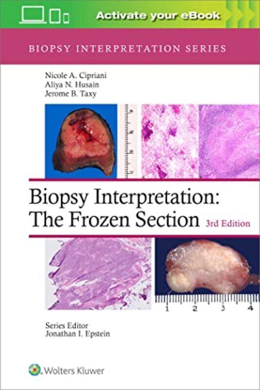 Biopsy Interpretation The Frozen Section Print eBook with Multimedia by Andrew University of Birmingham England PetersonJames Arthur-Hardcover
Biopsy Interpretation The Frozen Section Print eBook with Multimedia by Andrew University of Birmingham England PetersonJames Arthur-Hardcover