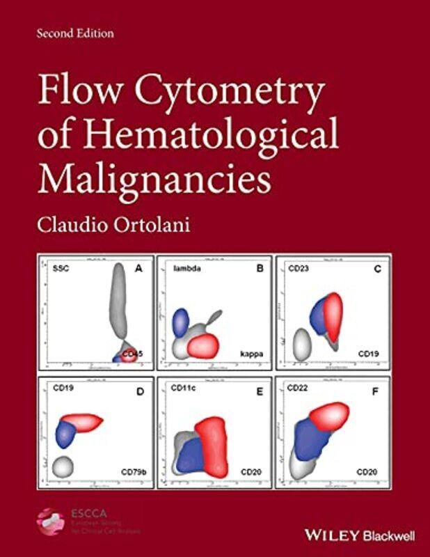 Flow Cytometry of Hematological Malignancies by Lauren EspyOdd DotLauren Espy-Hardcover
Flow Cytometry of Hematological Malignancies by Lauren EspyOdd DotLauren Espy-Hardcover