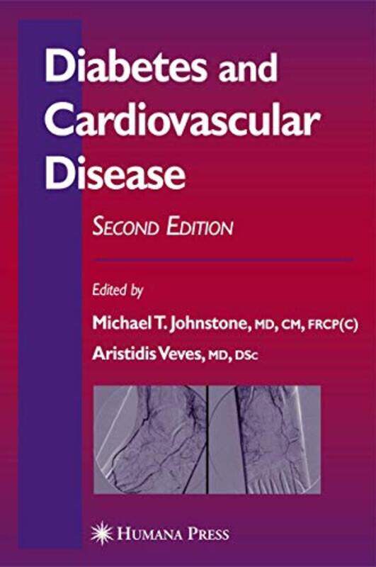 Diabetes and Cardiovascular Disease by Amit Georgia Tech University Prasad-Hardcover
Diabetes and Cardiovascular Disease by Amit Georgia Tech University Prasad-Hardcover