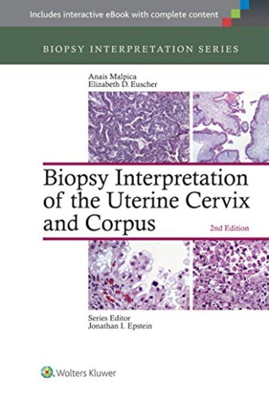 Biopsy Interpretation of the Uterine Cervix and Corpus by Anais MalpicaElizabeth D Euscher-Hardcover
Biopsy Interpretation of the Uterine Cervix and Corpus by Anais MalpicaElizabeth D Euscher-Hardcover