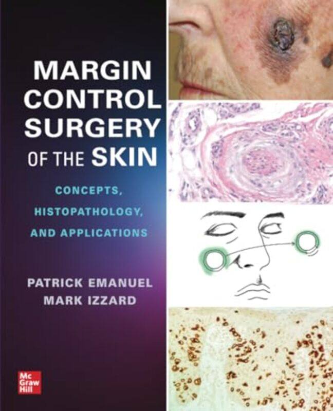 Margin Control Surgery of the Skin Concepts Histopathology and Applications by Ludger Ruschendorf-Paperback
Margin Control Surgery of the Skin Concepts Histopathology and Applications by Ludger Ruschendorf-Paperback