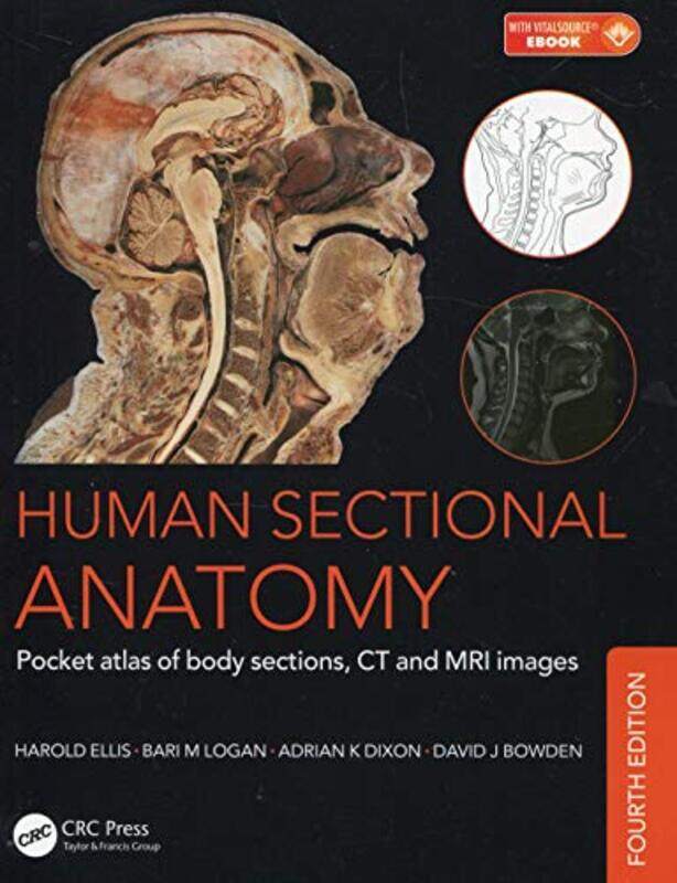 Human Sectional Anatomy Pocket Atlas Of Body Sections Ct And Mri Images Fourth Edition By Adrian Kendal Dixon Paperback
Human Sectional Anatomy Pocket Atlas Of Body Sections Ct And Mri Images Fourth Edition By Adrian Kendal Dixon Paperback