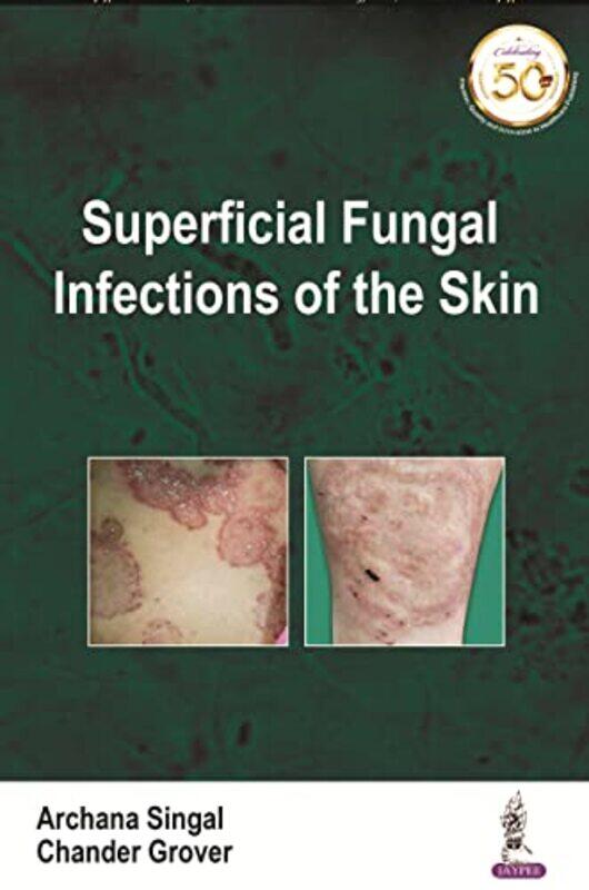 Superficial Fungal Infections Of The Skin By Singal, Archana - Grover, Chander - Paperback
Superficial Fungal Infections Of The Skin By Singal, Archana - Grover, Chander - Paperback