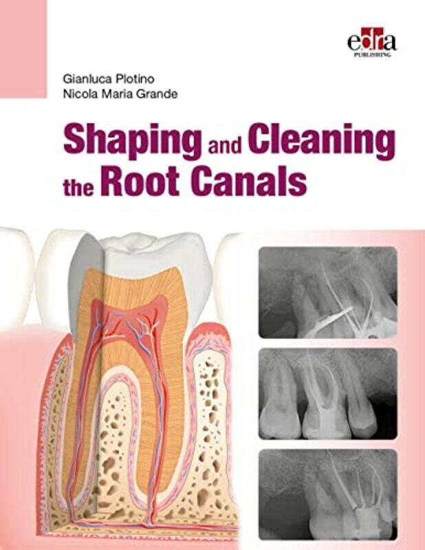 Shaping And Cleaning The Root Canal System by Gianluca PlotinoNicola Maria Grande-Paperback
Shaping And Cleaning The Root Canal System by Gianluca PlotinoNicola Maria Grande-Paperback
