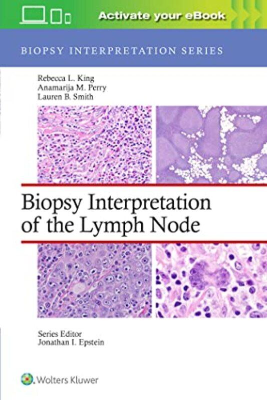 Biopsy Interpretation of the Lymph Node Print eBook with Multimedia by Jennifer WebbMarcello University of Nottingham UK Giovanelli-Hardcover
Biopsy Interpretation of the Lymph Node Print eBook with Multimedia by Jennifer WebbMarcello University of Nottingham UK Giovanelli-Hardcover