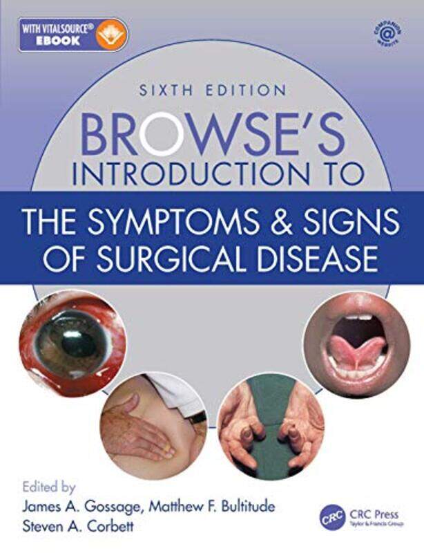 Browses Introduction to the Symptoms & Signs of Surgical Disease by Phillip WaddsNicholas ApoifisSusanne SchmeidlKim Spurway-Paperback
Browses Introduction to the Symptoms & Signs of Surgical Disease by Phillip WaddsNicholas ApoifisSusanne SchmeidlKim Spurway-Paperback