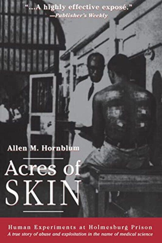 Acres of Skin by Jane E Center for Bioarchaeological Research School of Human Evolution and Social Change Arizona State University Tempe USA Buikstra-
Acres of Skin by Jane E Center for Bioarchaeological Research School of Human Evolution and Social Change Arizona State University Tempe USA Buikstra-