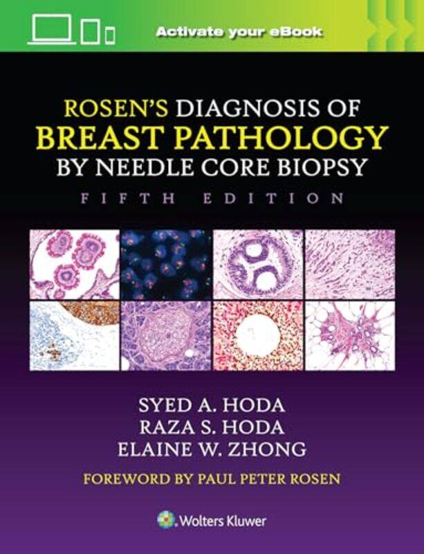 Rosen's Diagnosis of Breast Pathology by Needle Core Biopsy by Syed A. HodaRaza S. HodaElaine Zhong -Hardcover
Rosen's Diagnosis of Breast Pathology by Needle Core Biopsy by Syed A. HodaRaza S. HodaElaine Zhong -Hardcover
