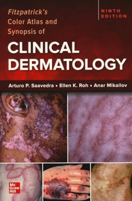 Fitzpatricks Color Atlas and Synopsis of Clinical Dermatology Ninth Edition by Catherine BatesAbi Matthewman-Paperback
Fitzpatricks Color Atlas and Synopsis of Clinical Dermatology Ninth Edition by Catherine BatesAbi Matthewman-Paperback
