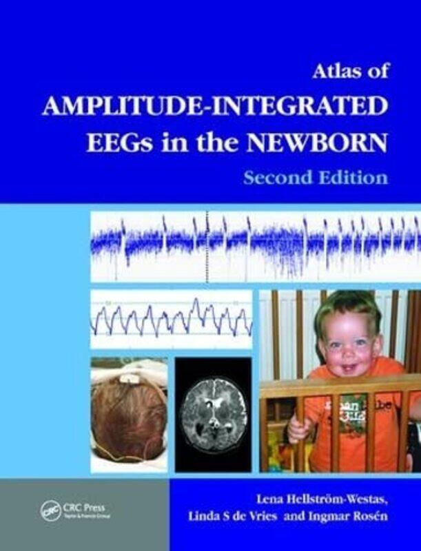 An Atlas of AmplitudeIntegrated EEGs in the Newborn by Dr Chris Washington and Lee University USA GavalerLeigh Ann Washington and Lee University USA B
An Atlas of AmplitudeIntegrated EEGs in the Newborn by Dr Chris Washington and Lee University USA GavalerLeigh Ann Washington and Lee University USA B