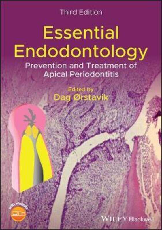 Essential Endodontology - Prevention and Treatment of Apical Periodontitis, 3rd Edition,Hardcover,ByOrstavik
Essential Endodontology - Prevention and Treatment of Apical Periodontitis, 3rd Edition,Hardcover,ByOrstavik