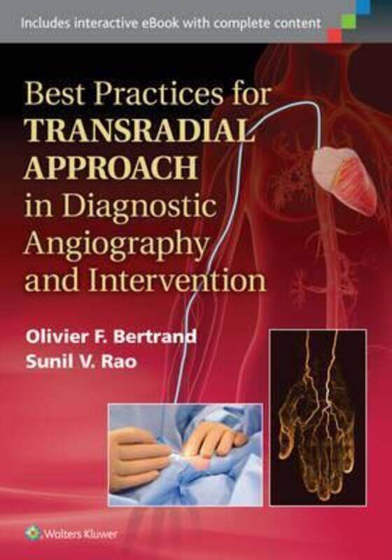Best Practices for Transradial Approach in Diagnostic Angiography and Intervention, Hardcover Book, By: Olivier Bertrand
Best Practices for Transradial Approach in Diagnostic Angiography and Intervention, Hardcover Book, By: Olivier Bertrand