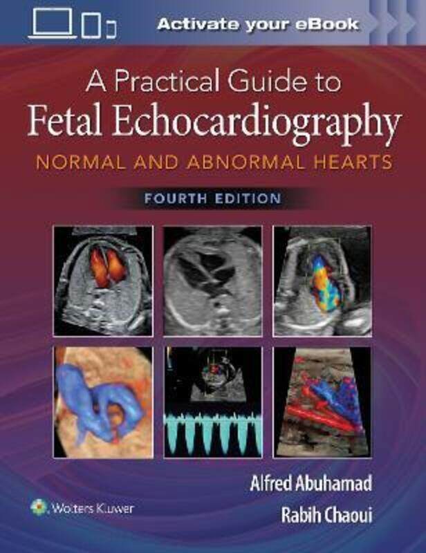 A Practical Guide to Fetal Echocardiography: Normal and Abnormal Hearts,Hardcover,ByAbuhamad, Alfred Z. - Chaoui, Rabih
A Practical Guide to Fetal Echocardiography: Normal and Abnormal Hearts,Hardcover,ByAbuhamad, Alfred Z. - Chaoui, Rabih
