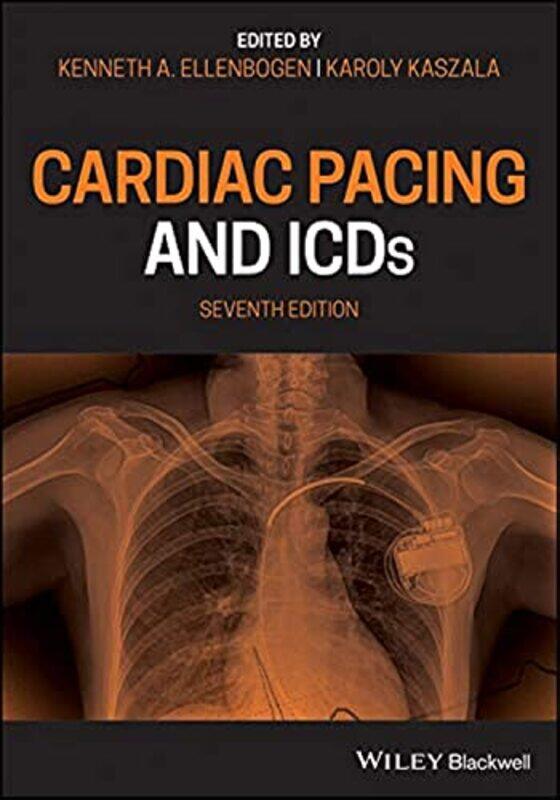 Cardiac Pacing and ICDs by Kenneth A Medical College of Virginia EllenbogenKaroly Medical College of Virginia / VCU School of Medicine, Richmond, VA,
Cardiac Pacing and ICDs by Kenneth A Medical College of Virginia EllenbogenKaroly Medical College of Virginia / VCU School of Medicine, Richmond, VA,