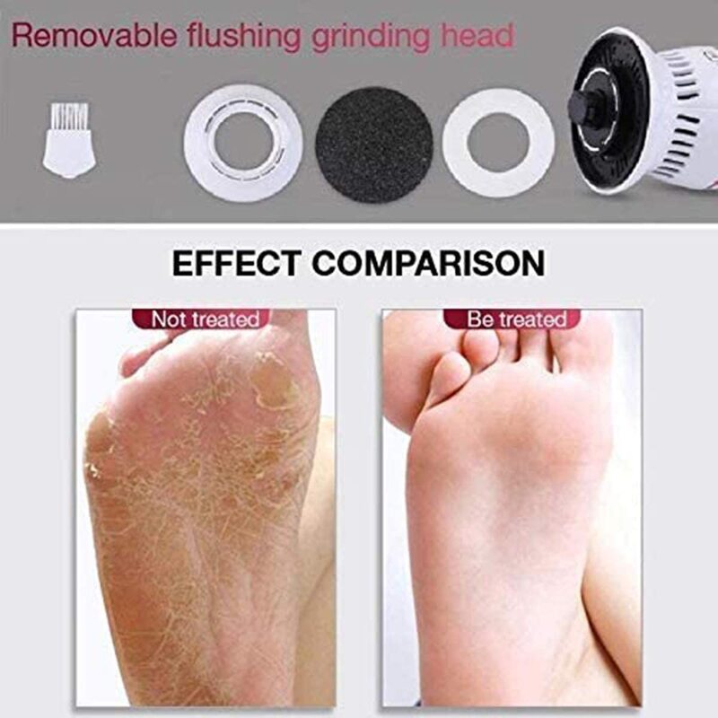 Dreamslink Portable Electric Vacuum Absorption Foot Grinder with USB for Dead, Hard Cracked Dry Skin, White