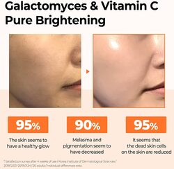 Some By Mi Galactomyces Pure Vitamin C Glow Serum, 30ml