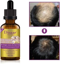 Disaar Beauty Natural Hair Growth Ginger Anti Hair Loss Essence Healthy Strong Thick Hair Essential Oil, 30 gm