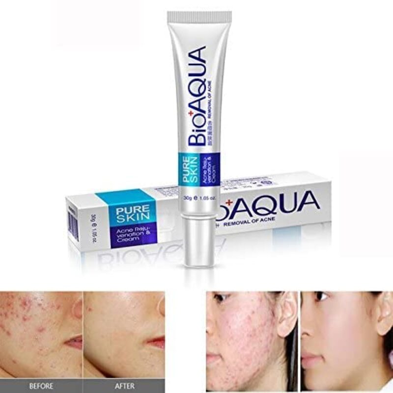 BioAqua Pure Skin Acne Remover Cream, 30gm