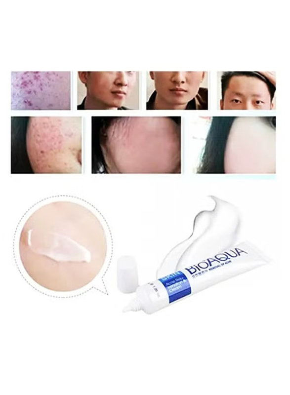 Bioaqua Pure Skin Acne Treatment Scar Removal Cream, 30gm