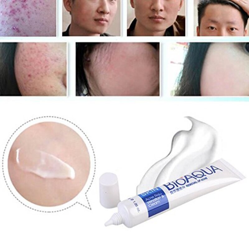 Bioaqua Acne Rejuvenation Cream, 30g