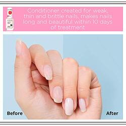 Eveline Maximum Nail Growth Quickener, Clear