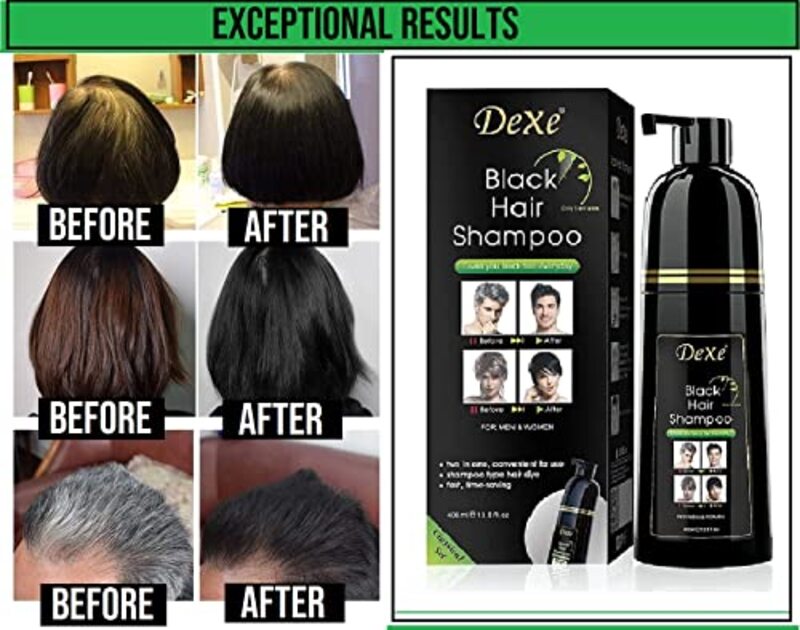 Dexe Herbal 3-in-1 Instant Black Hair Dye Shampoo for Damaged Hair, 400ml