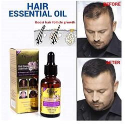 Disaar Anti-Hair Loss Essential Oil, 40ml