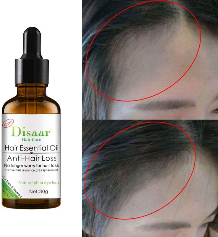 Disaar Hair Care Anti Hair Loss Treatment Fast Thicker Increase Hair Essential Oil, 30g