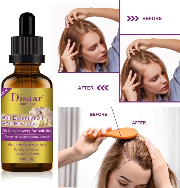 Disaar Beauty Natural Hair Growth Ginger Anti Hair Loss Essence Healthy Strong Thick Hair Essential Oil, 30 gm