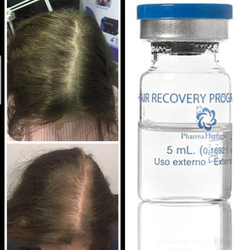 Pharma Hermetic Hair Recovery Program SP55 Vials, Set