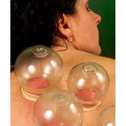 Professional Glass Cupping Therapy Sets Size #4 (8pcs/set)