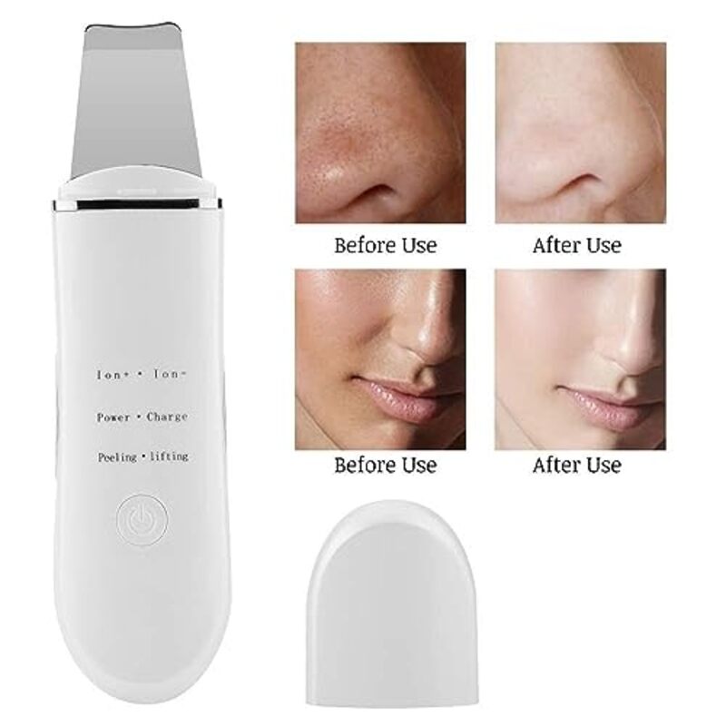 Global Fashion Professional Ultrasonic Deep Cleansing Skin Scrubber, 1 Piece