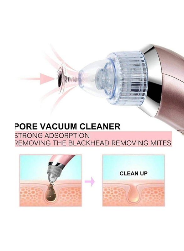 Gennext Usb Charge Diamond Dermabrasion Dead Skin Remover & Facial Pores Vacuum Cleaner, Beige