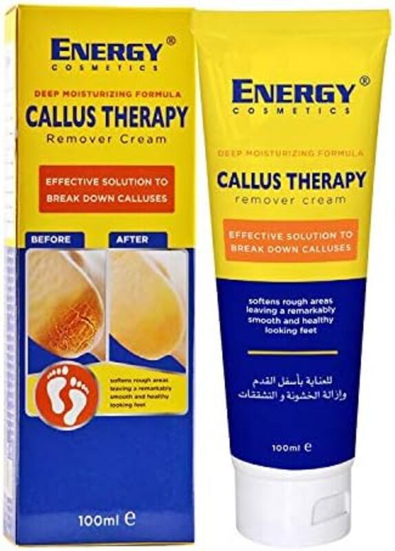 Energy Cosmetics Callus Therapy Remover Cream, 100ml