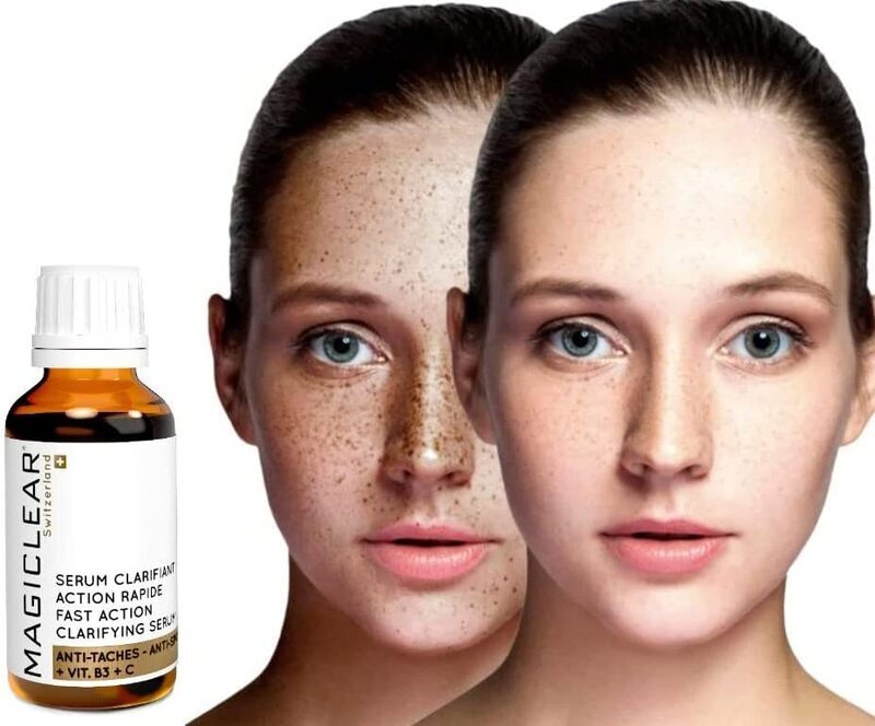 Magiclear Luxury Dark Spot Remover for Face & Body Serum, 30ml