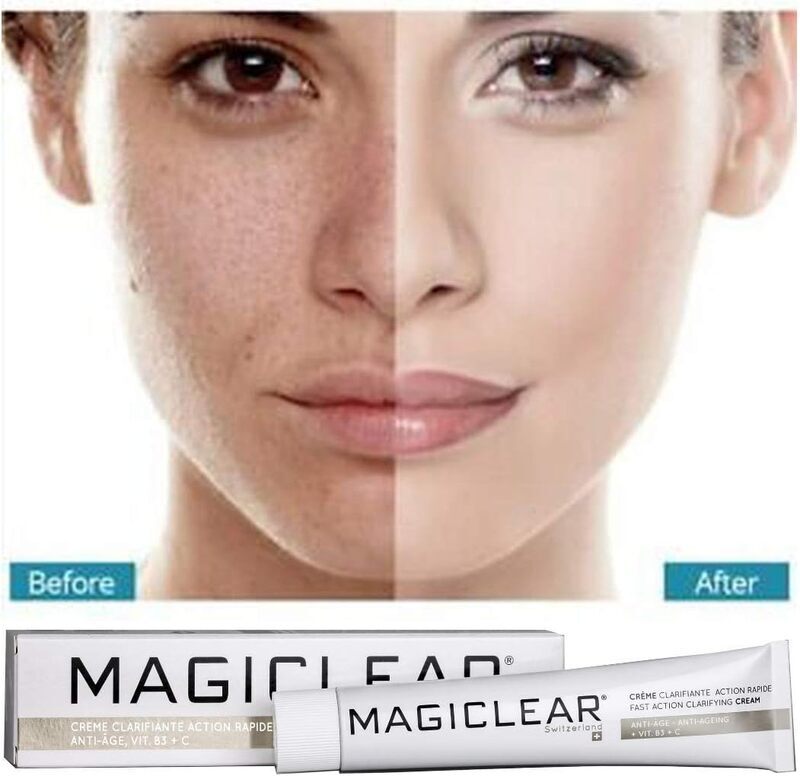 Magiclear Luxury Blemish Dark Spot Corrector Remover Cream, 50ml