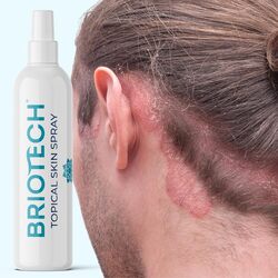 BRIOTECH Topical Skin Spray, Hypochlorous Acid Spray for Body & Face, Eyelid Cleanser, HOCl Facial Mist, Support Against Irritation, Calm Redness, Soothe Foot & Scalp, Packaging May Vary, 3.4 oz, 1 ct