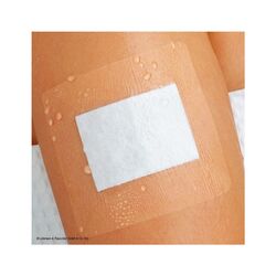 TRANSPARENT WOUND DRESSING 10*10CM 50S